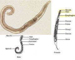 <p>ridged extensions of the cuticle that aids in movement, providing support, and act as sensory receptors</p>