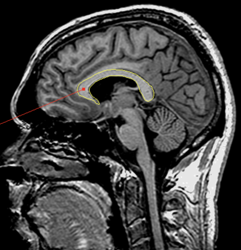 <p>What is the area highlighted called?</p>