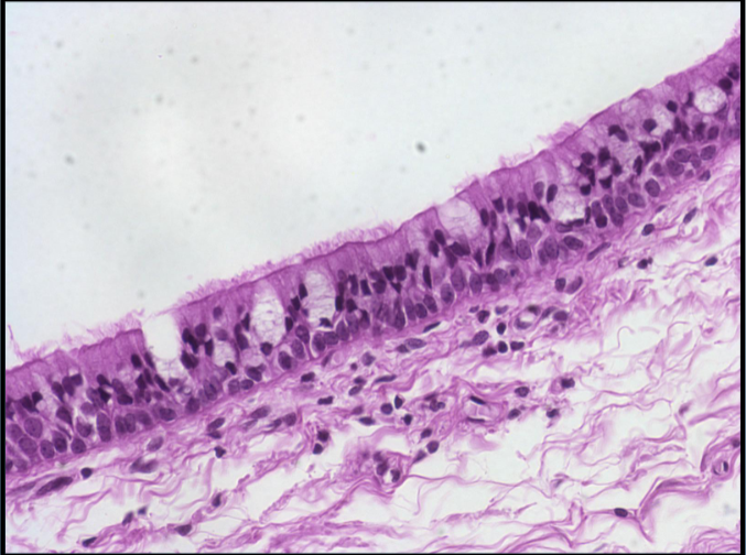<p>Function: protection and secretion<br>found in trachea and bronchi of lungs</p>