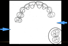 <p>For Applegate's classification:</p><p>Which arrow represents the modification?</p>
