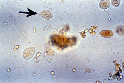 <p>Identify the parasite</p>