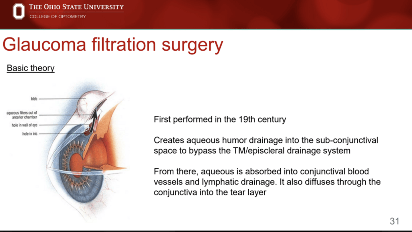 <p>What is the function of glaucoma filtration surgery?</p>