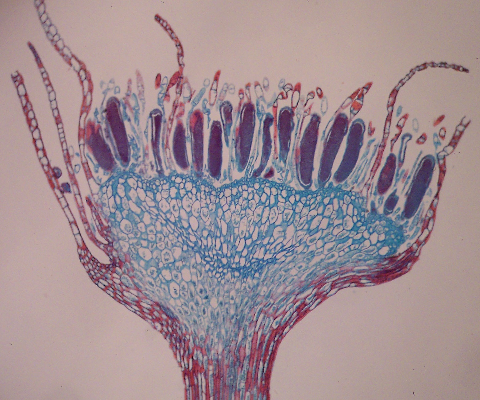 <p>Antheridium</p>