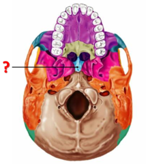 <p>Identify this bone.</p>