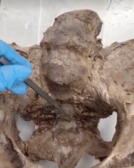 <p>Name the ligament</p>