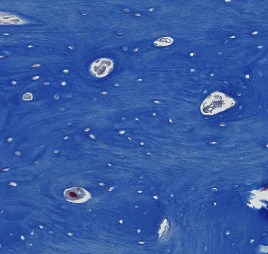 <p>ID the bone type shown in this trichrome stain</p>