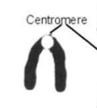 <p>Which type of chromosome is it?</p>
