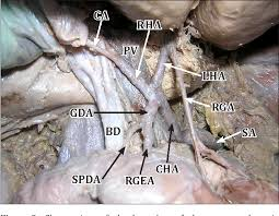 <p>branches to the right</p><p>3rd branch of the celiac trunk </p><ul><li><p>structure</p></li></ul><p></p>