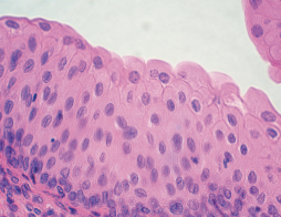 <p>tissue location </p>