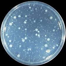 <p>What method of dilution involves diluted cells being mixed with molten agar while it is still warm and then being poured into a petri plate to grow bacterial "lawns”?</p>