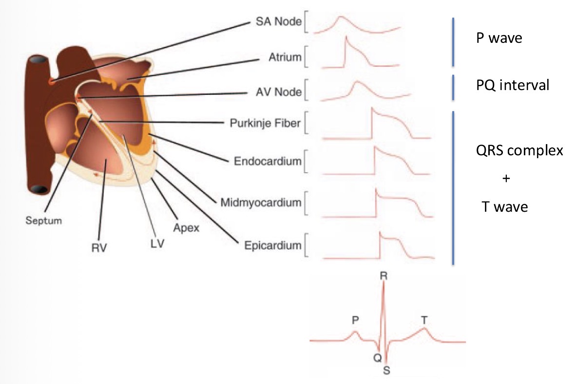 <p>P - The APs in the atria</p><p>Q, R, S - shift of the AP peaks in the ventriclesn (highest amplitude because it has the highest muscle mass)</p><p>T - reflects the repolarization of the heart</p>