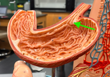 <p>What is the arrow pointing at?</p>