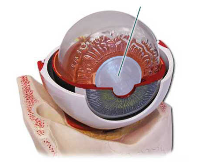 term image