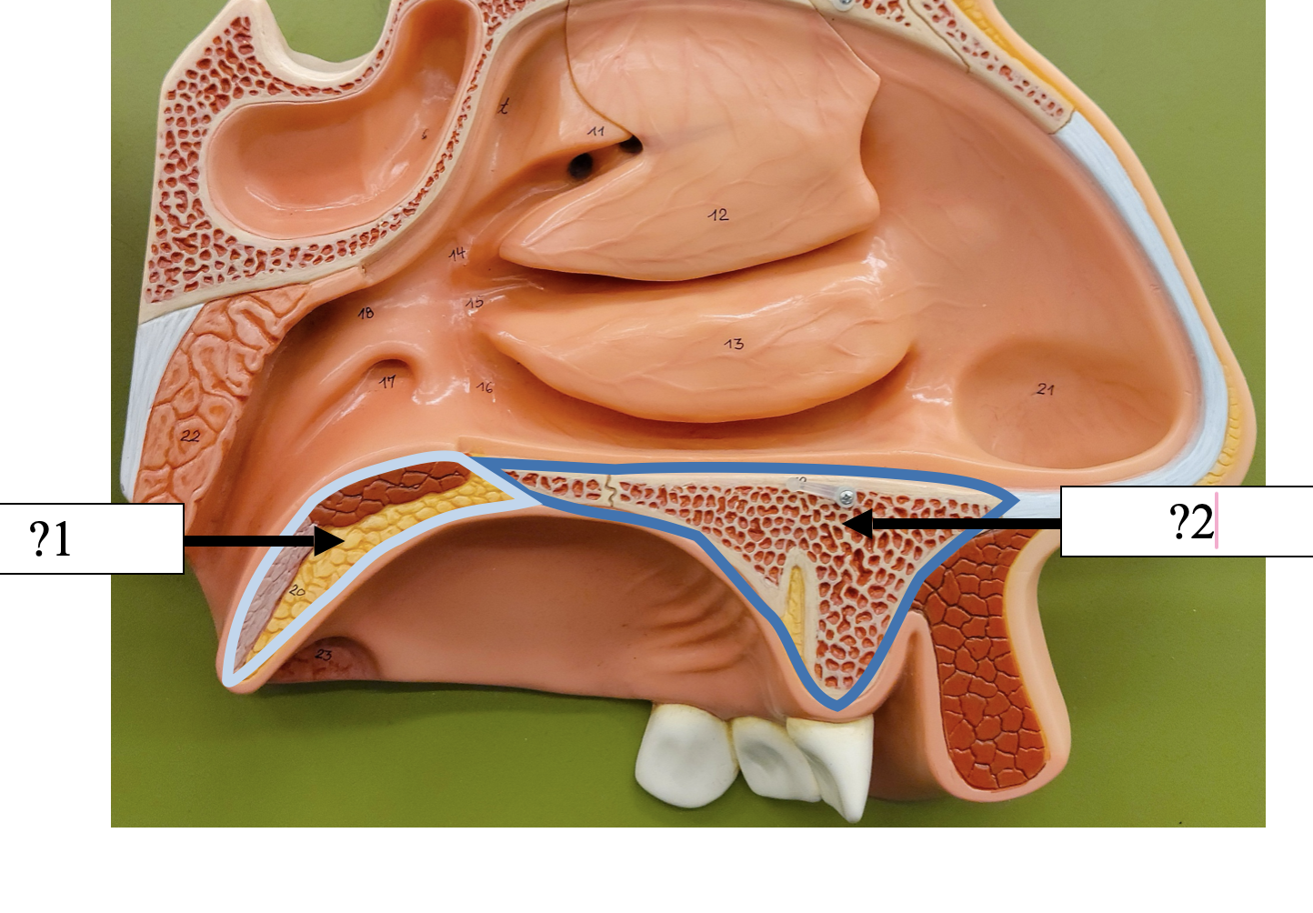 <p>1 Name the tissue?</p>