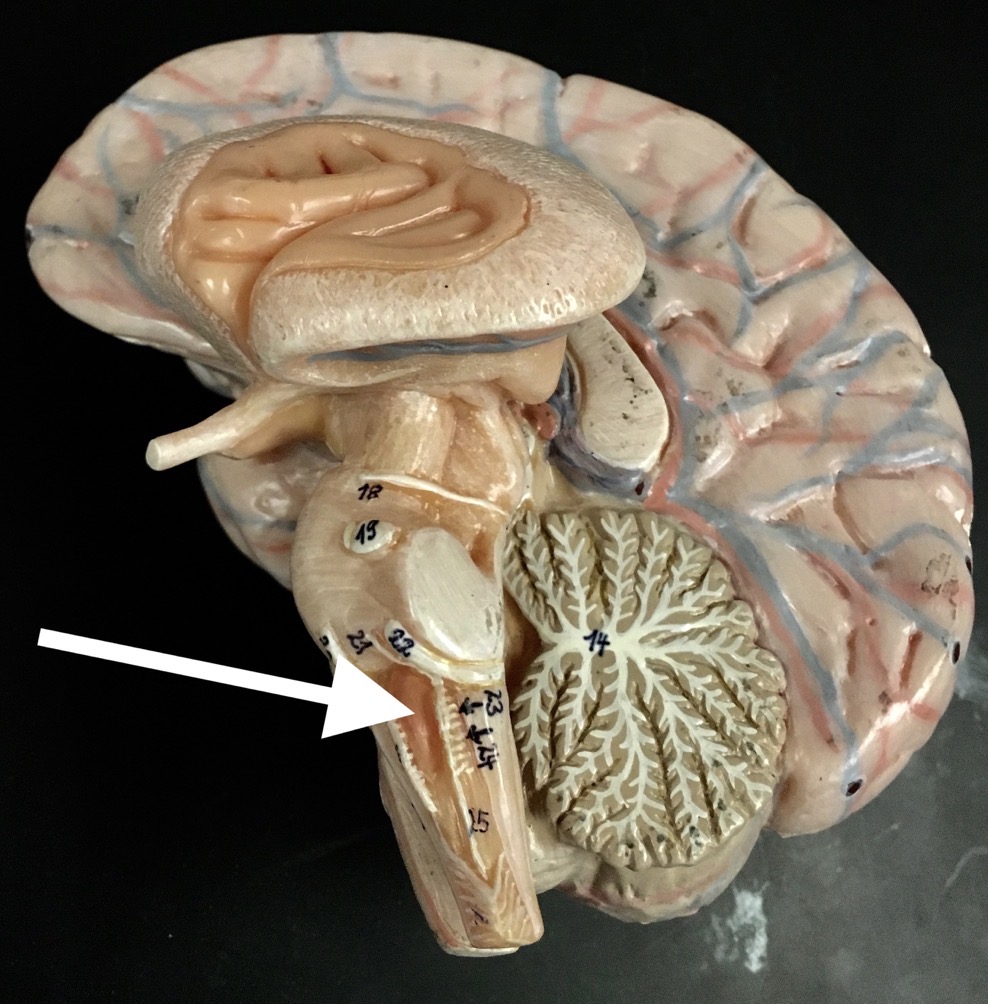 <p>What is the pink structure the arrow is pointing to?</p>