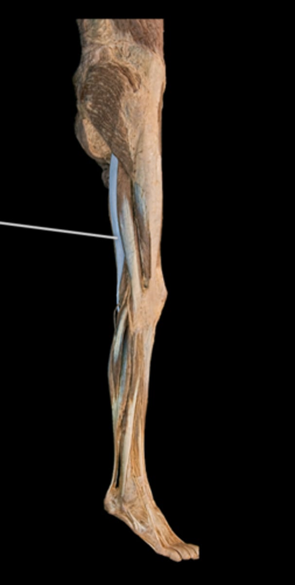 <p>What muscle is this?</p>