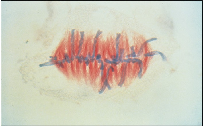 <p>What stage of mitosis is this?</p>