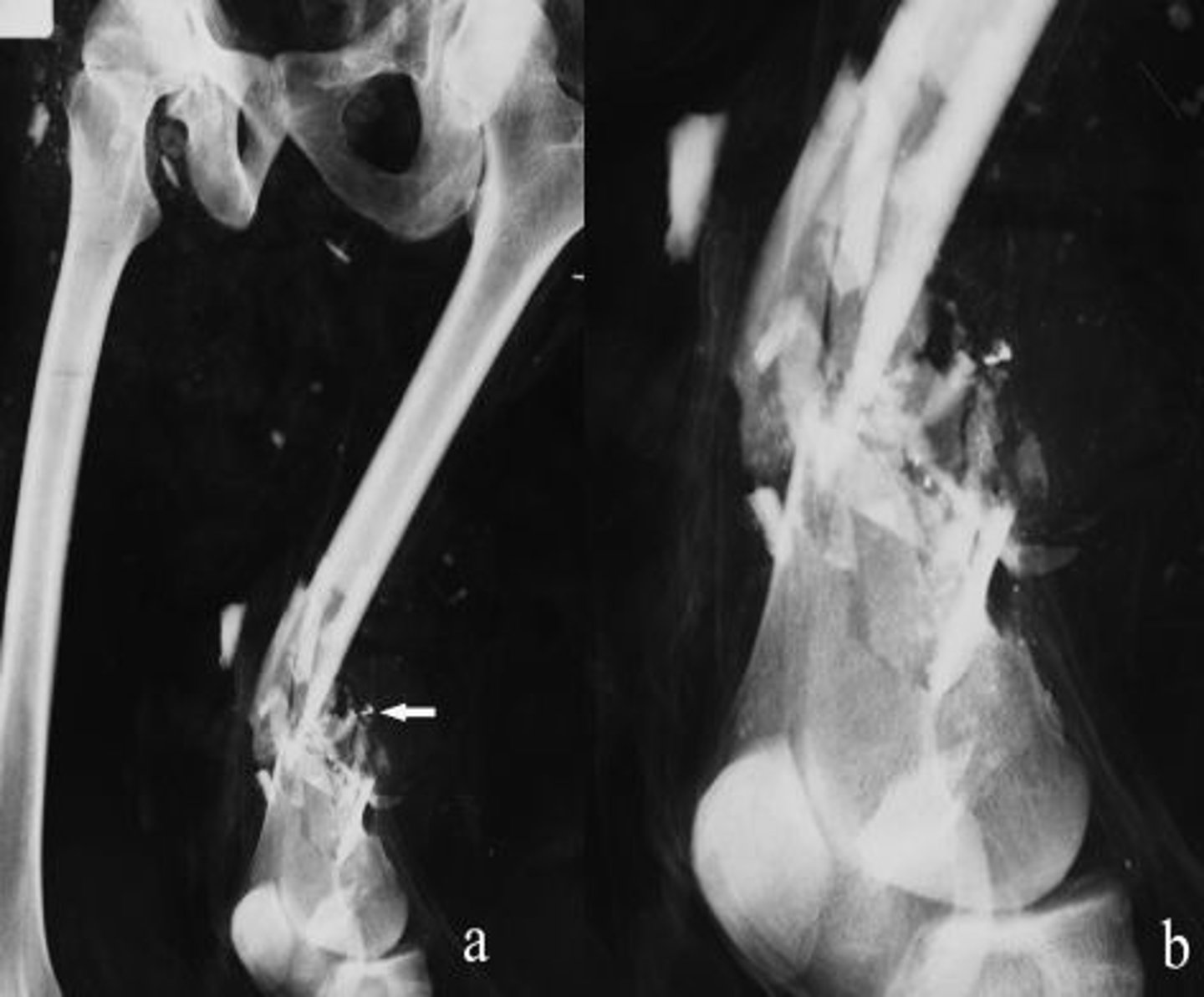 <p>Multiple fracture lines from high-impact trauma.</p>