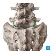 <ul><li><p><span style="font-family: "Century Gothic";">Articulation between L5 and S1</span></p></li><li><p><span style="color: red;"><strong>Intervertebral symphysis </strong>and <strong>Zygapophyseal </strong></span><span style="font-family: "Century Gothic"; color: red;">(facet) <strong>synovial joint</strong></span></p></li><li><p><span style="font-family: "Century Gothic";">Highly weight bearing transition point between lumbar and sacrum</span></p></li><li><p><span style="font-family: "Century Gothic";">High stress at the lumbosacral angle</span></p></li><li><p><strong>Clinical correlation:</strong></p><ul><li><p><span style="font-family: "Century Gothic";">Common site of herniated disc, spondylolisthesis, degenerative changes</span></p></li></ul></li></ul><p></p>