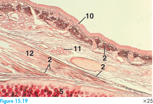 <p>viewing elastic fibers </p><p><strong>natural dye</strong> obtained from lichens</p>