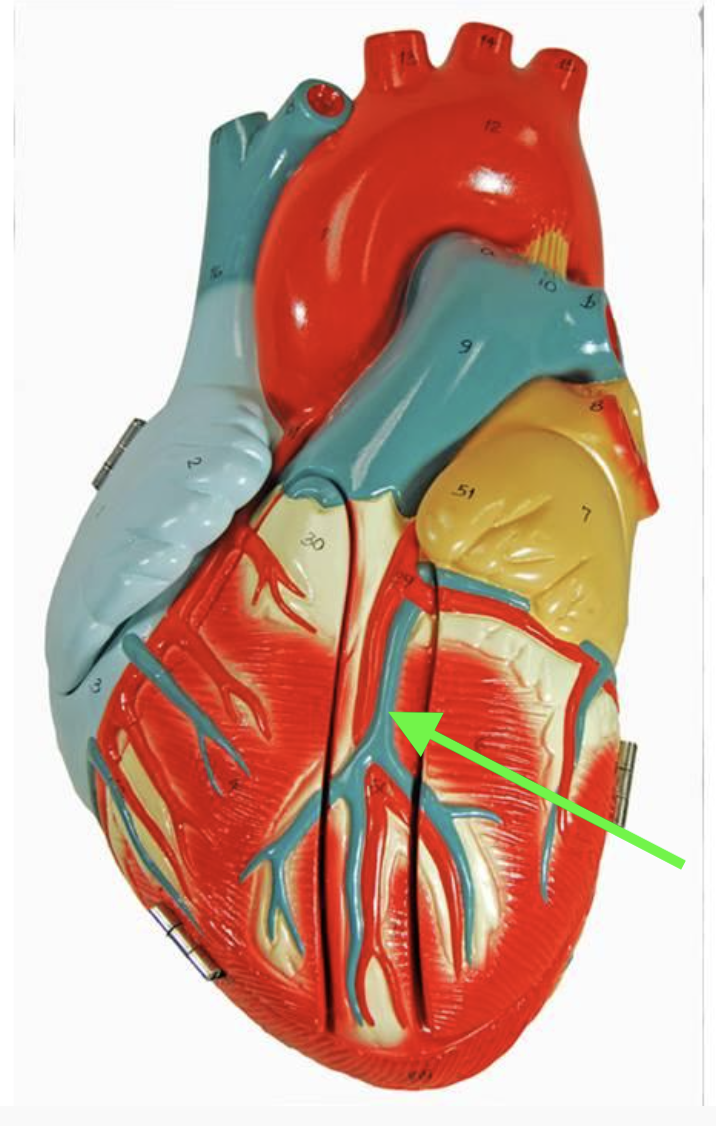 <p><strong>Identify the indicated vessel.</strong></p>