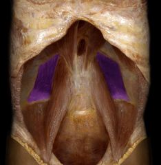 <p>identify the structure</p>