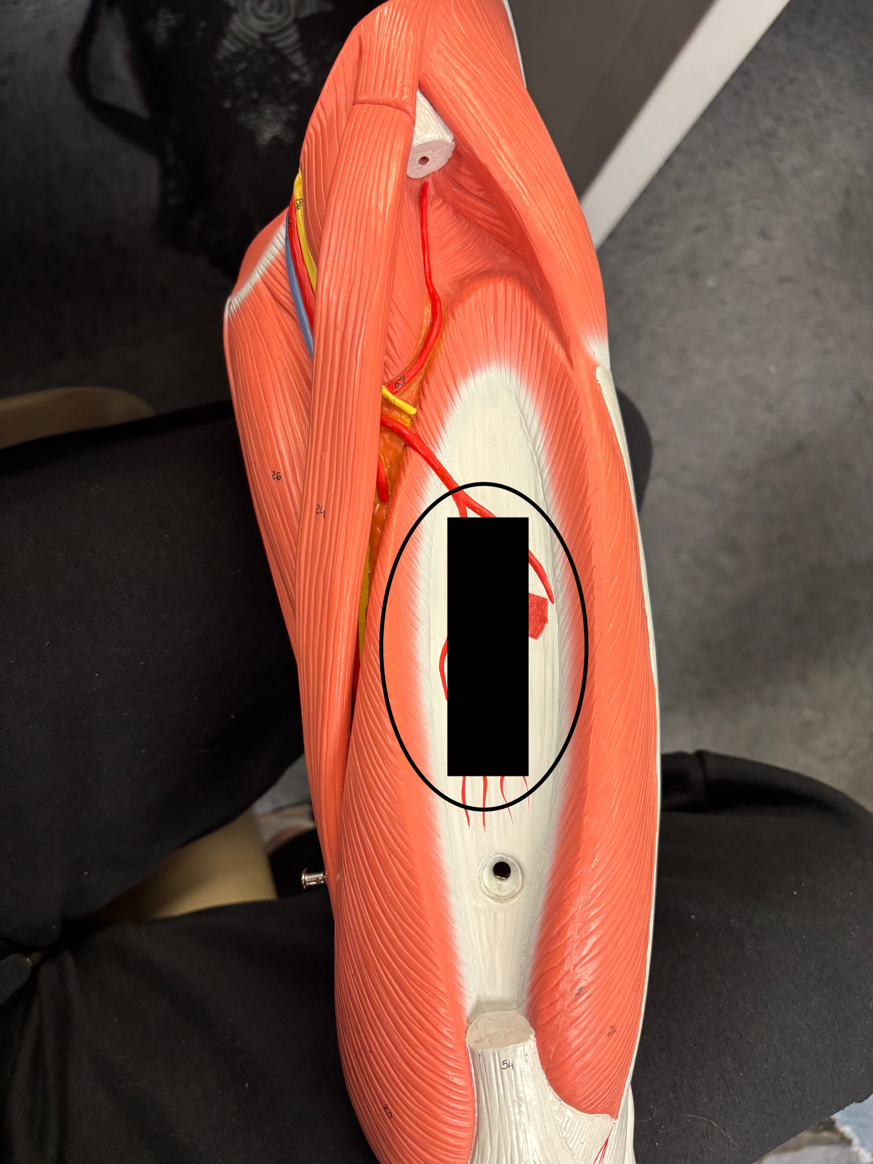 <p>What muscle is this and what is its action?</p>