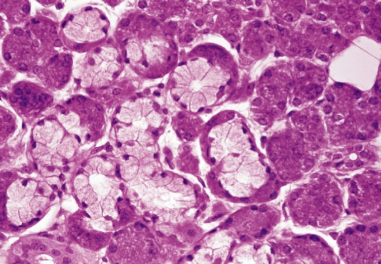<p>What type of gland is this?</p>