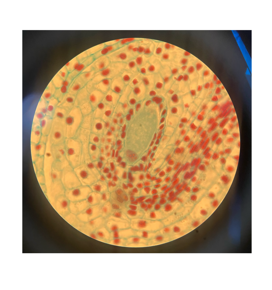 <p>Is this Meiosis or Mitosis?</p>