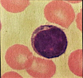 <p>lymphocytes (agranulocyte) </p>