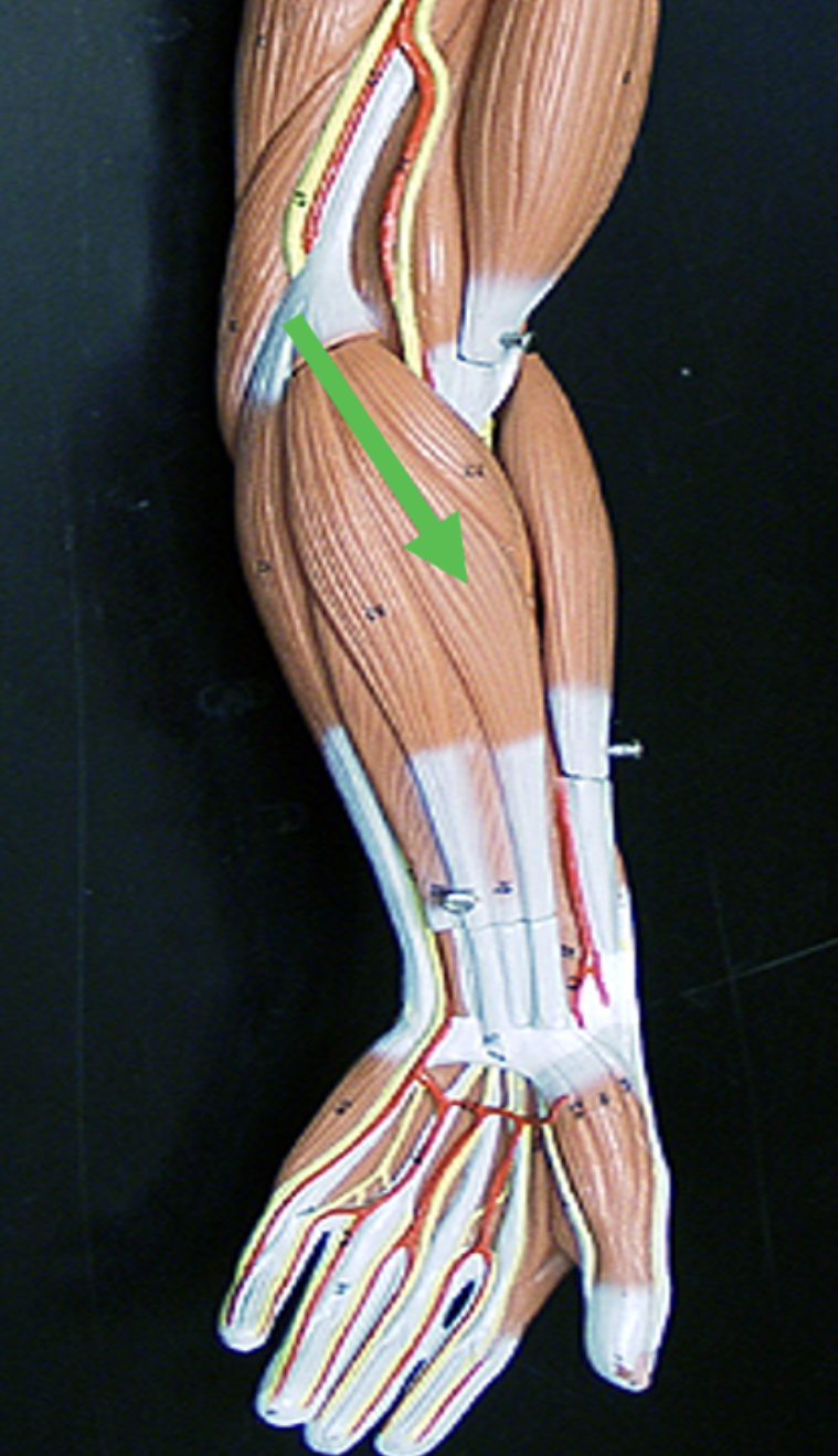 <p>Identify the muscle indicated by the pointer.</p>