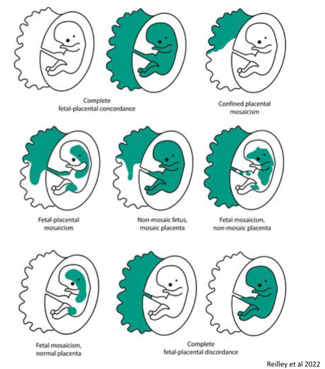 <p>****Which of combinations is the Case study? CVS = Mosaic trisomy 16 + Amniocentesis = normal karyotype</p>