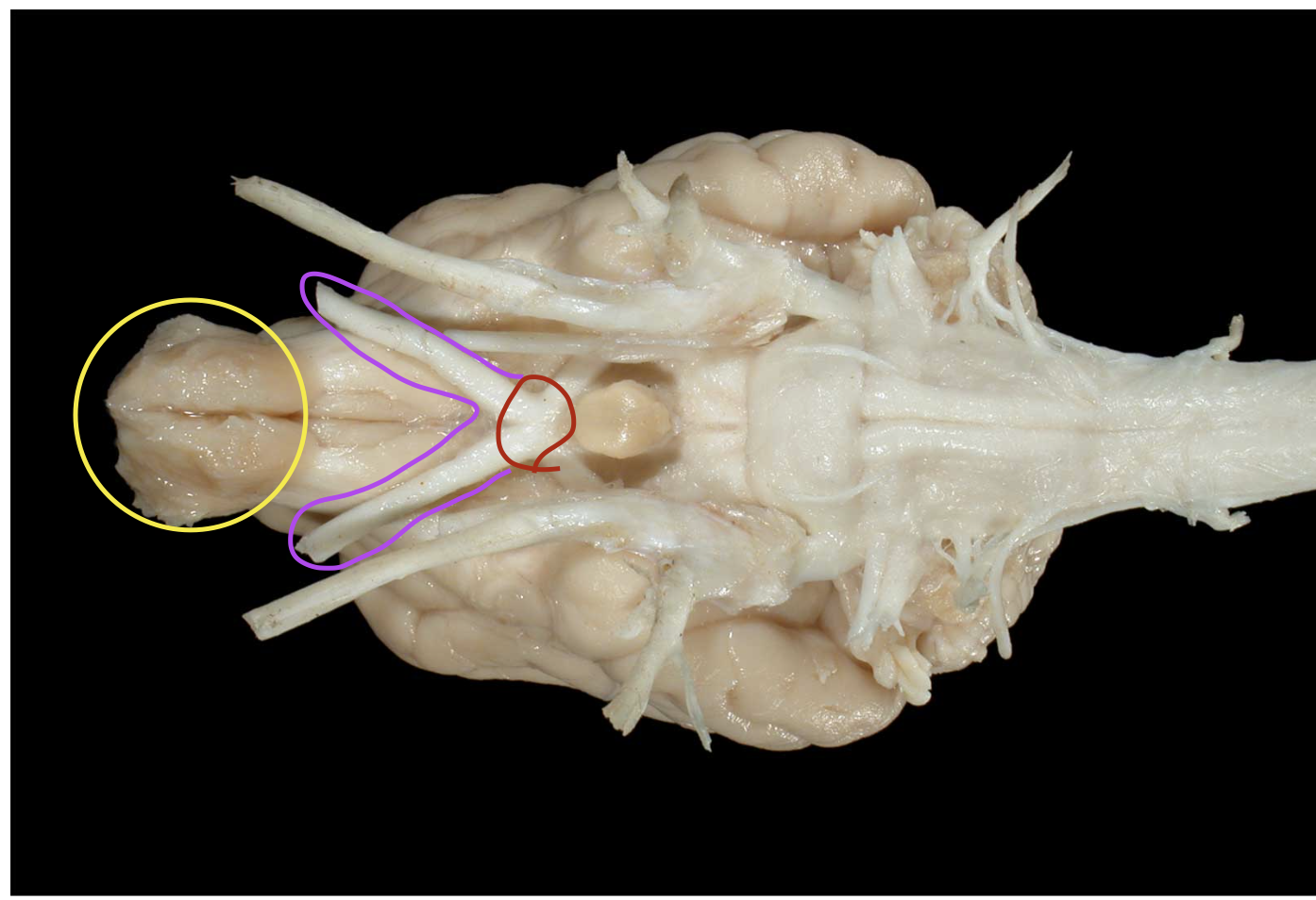 <p>what is purple and red </p>