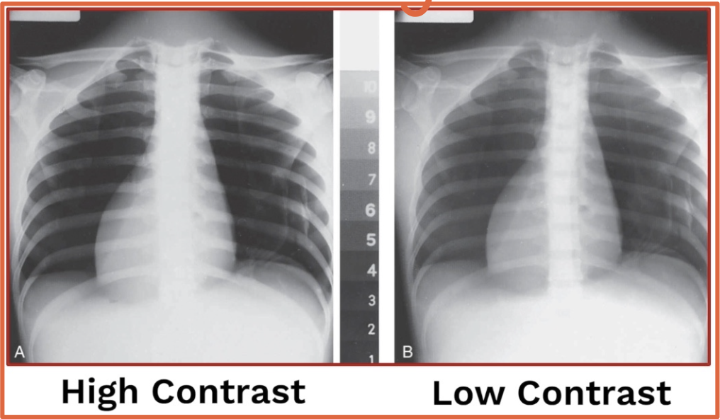 <ul><li><p>Thoracic spine → HIGH contrast &amp; A-P</p></li><li><p>Chest x-ray → LOW contrast &amp; P-A</p><ul><li><p>PA-PA’s chest</p></li></ul></li></ul><p></p>