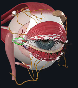 term image