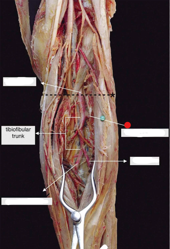 <p>Identify the structure pinned</p>