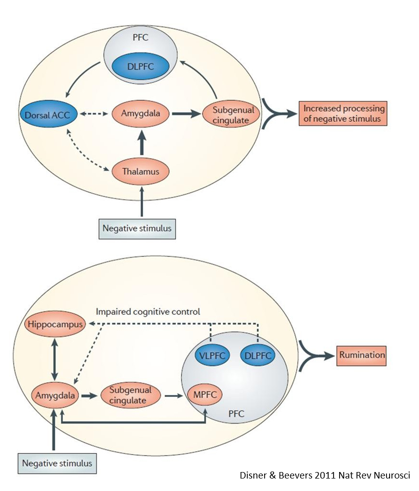 <p>Cognitief model van depressie - Beck: <u>negatieve bias bij de verwerking van emotionele info</u></p><ul><li><p>disfunctionele schema’s geactiveerd door <strong>negatieve stimuli</strong></p><ul><li><p>disproportionele aandacht &amp; sterker verwerkt</p></li></ul></li><li><p><u>hyperactiviteit van amygdala</u></p></li><li><p><u>hypoactiviteit in dlPFC</u> </p></li></ul><p>Gelinkt met bias in gedachten over negatieve emotionele stimuli</p><ul><li><p><u>MPFC faalt in regulatie van negatieve emoties</u> &amp; hyperactief in default mode netwerk met <u>disfunctionele zelf-referentie &amp; ruminatie</u></p></li></ul><p></p>