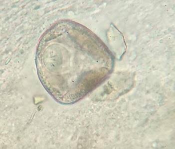 <img src="blob:null/40843681-9c08-494c-86f4-d3885432f0e9"><p></p>