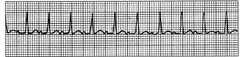 <p>Which rhythm is this?</p>
