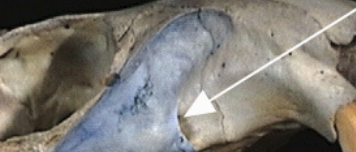 <p>________ foramen is the hole under orbital</p>