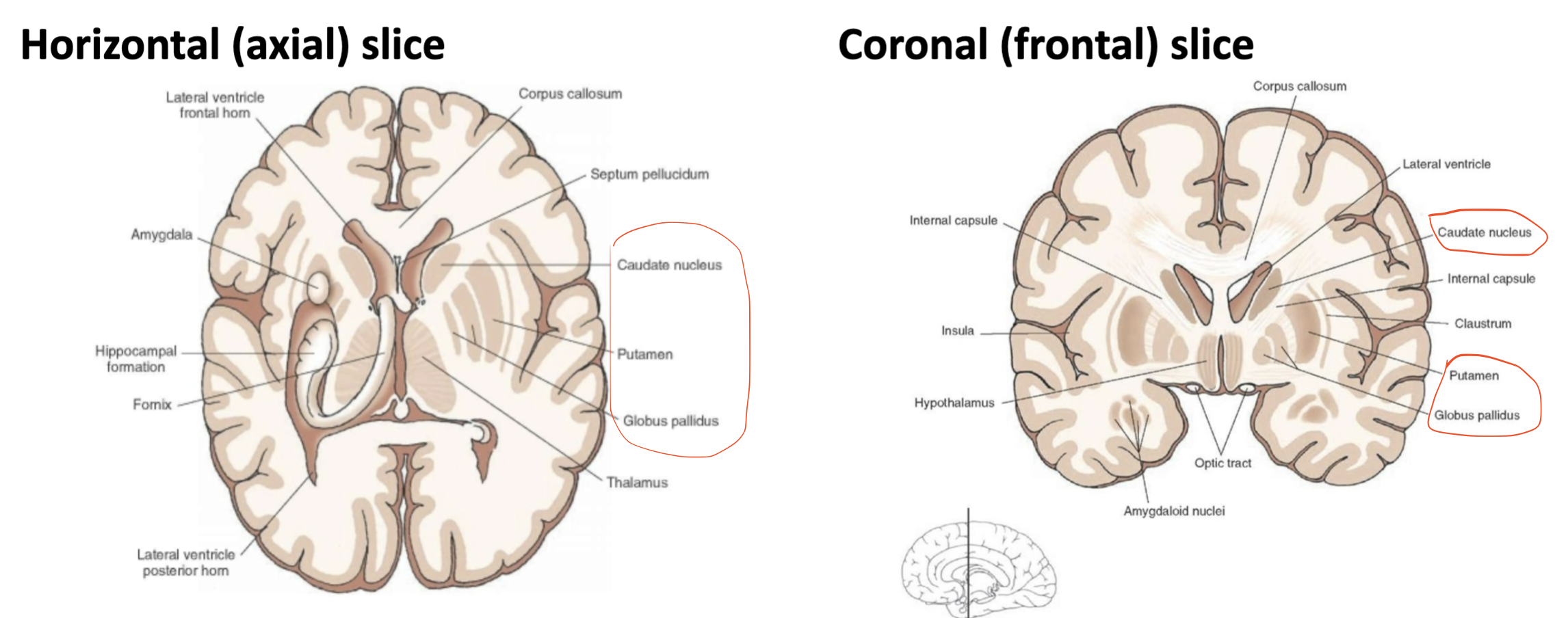 <p>Subcortical gray matter- Basal Ganglia</p>