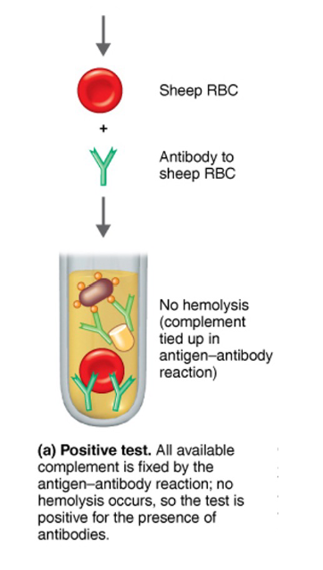 <p>3. As a test indicator, sheep RBC are introduced into the patient’s serum sample. Antibodies against sheep RBC are also introduced into the patient’s serum sample. An immune complex will form between the Sheep’s RBCs and Antibodies against sheep RBCs.</p><p>4. No Hemolysis of sheep RBC occurs because the compliment did not bind to the Antibodies against sheep</p><p>RBC. This is part of the “indicator Stage” of the test. Compliment did not bind because it was all “used-up” and</p><p>already fixed (in the compliment fixation step) with the 1st immune complex. Thus, compliment is no longer available. No hemolysis of sheep RBC indicates a positive Test for the Patient’s Antibodies, and thus, positive for the disease.</p>
