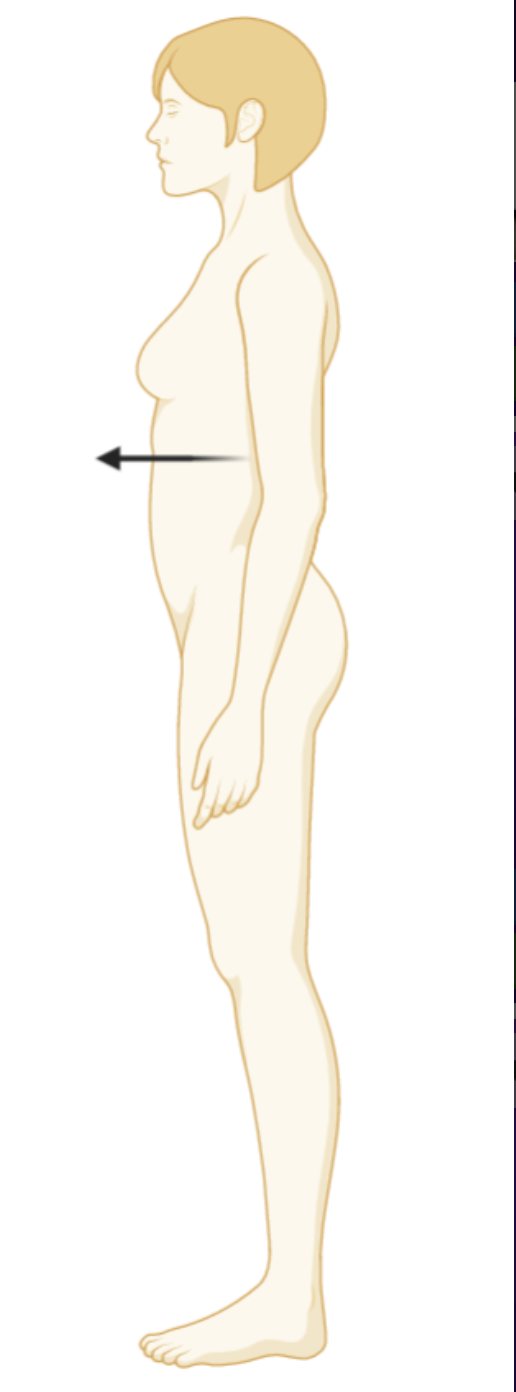 <p>What anatomical direction is the arrow point? </p>