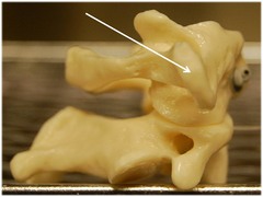 <p>Name this specific part of the atlas (C1).</p>