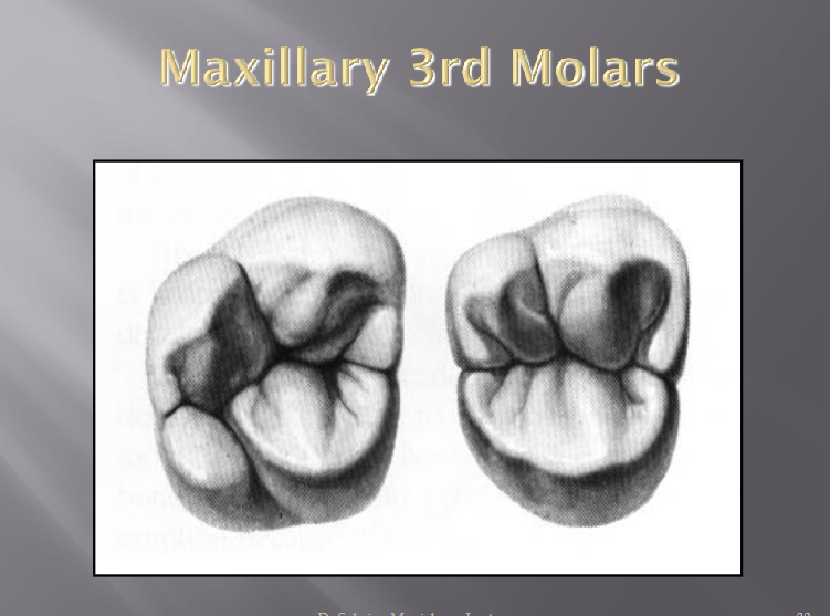 <p>Varies in form more than any others</p><p>Usually has no DP cusp</p><p>Occlusal outline is heart shaped with 3 cusps</p><p>Usually 3 very close together or fused roots with extreme distal inclination </p>