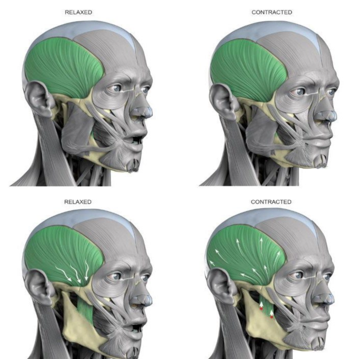 <ul><li><p>raises mandible.</p></li><li><p>helps retract mandible (posterior fibres)</p></li></ul><p></p>