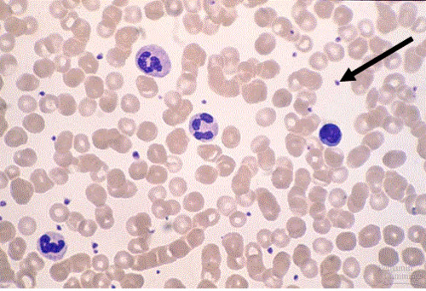 <p>type of cell fragment?</p>