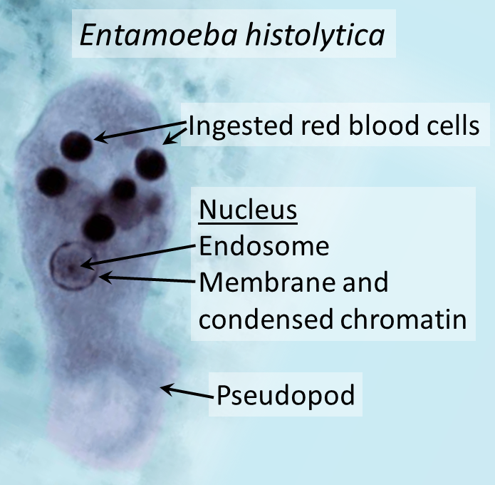 <ul><li><p>causes <strong><u>amoebic dysentery</u></strong></p></li><li><p><strong>symptoms</strong></p><ul><li><p>cramping, fever, bloody/mucusy diarrhea, characteristic lesions in the intestines (flask-shaped ulcers)</p></li></ul></li><li><p>can cause <u>hepatic abscess</u></p><ul><li><p>organism can erode intestinal mucosa, enter circulation, and colonize the liver (causes increased WBCs and liver enzymes)</p></li></ul></li><li><p><em>picture: trophozoite form</em></p></li></ul><p></p>