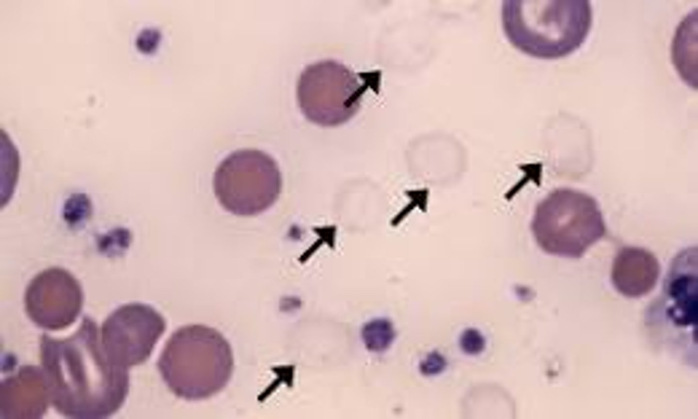 <p>Ghost cell</p>