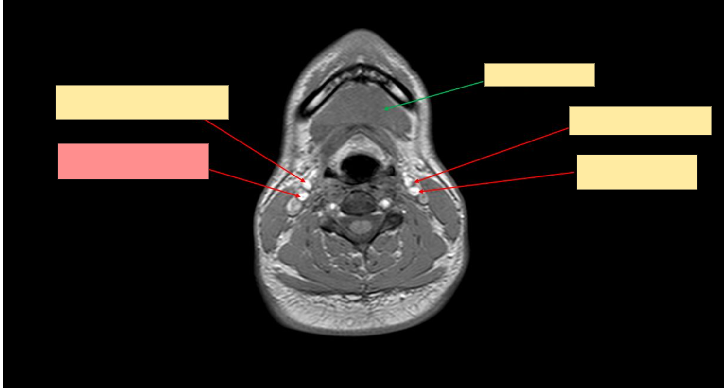 <p>Name the structure</p>